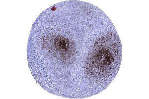 Lymph node In lymph nodes a strong CD23 immunostaining is seen in follicular dendritic cells of germinal centres while staining is moderate in follicular and perifollicular B lymphocytes