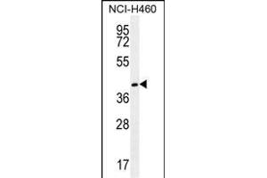 GGH Antibody (C-term) (ABIN655984 and ABIN2845368) western blot analysis in NCI- cell line lysates (35 μg/lane). (GGH anticorps  (C-Term))