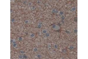 Used in DAB staining on fromalin fixed paraffin- embedded Kidney tissue (SCAND3 anticorps  (AA 366-526))