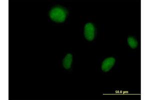 Immunofluorescence of purified MaxPab antibody to DCK on HeLa cell. (DCK anticorps  (AA 1-260))