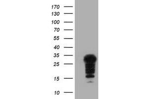 Image no. 1 for anti-Synovial Sarcoma, X Breakpoint 5 (SSX5) antibody (ABIN1501163) (SSX5 anticorps)