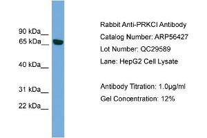 WB Suggested Anti-PRKCI  Antibody Titration: 0. (PKC iota anticorps  (Middle Region))