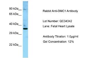 Host: Rabbit Target Name: DMC1 Sample Type: Fetal Heart Antibody Dilution: 1. (DMC1 anticorps  (N-Term))
