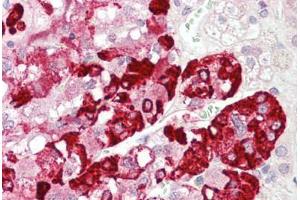 Human Adrenal: Formalin-Fixed, Paraffin-Embedded (FFPE)