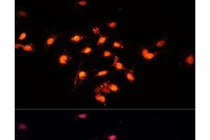 Immunofluorescence analysis of C6 cells using GTF3C4 Polyclonal Antibody at dilution of 1:100 (40x lens). (GTF3C4 anticorps)