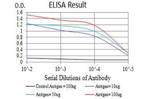 Black line: Control Antigen (100 ng),Purple line: Antigen (10 ng), Blue line: Antigen (50 ng), Red line:Antigen (100 ng)