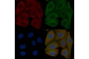 Occludin Mouse Monoclonal Antibody staining Hela cells by IF/ICC. (Occludin anticorps  (C-Term))