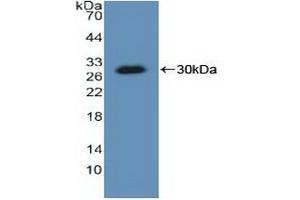Detection of Recombinant KARS, Human using Polyclonal Antibody to Lysyl tRNA Synthetase (KARS) (KARS anticorps  (AA 323-553))