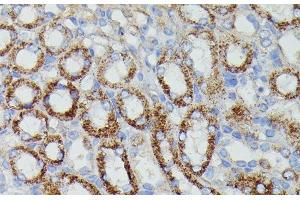 Immunohistochemistry of paraffin-embedded Mouse kidney using NDUFAB1 Polyclonal Antibody at dilution of 1:100 (40x lens). (NDUFAB1 anticorps)