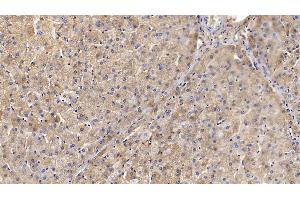 Detection of TF in Porcine Liver Tissue using Polyclonal Antibody to Transferrin (TF) (Transferrin anticorps)