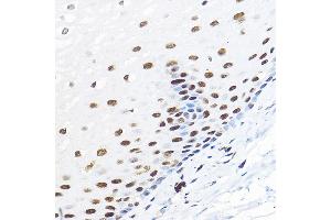 Immunohistochemistry of paraffin-embedded human esophageal using GTF2B Rabbit pAb (ABIN7267370) at dilution of 1:100 (40x lens). (GTF2B anticorps  (AA 50-150))