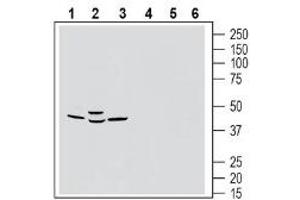 Western blot analysis of rat brain membranes (lanes 1 and 4), mouse brain lysates (lanes 2 and 5) and rat lung membranes (lanes 3 and 6): - 1-3.