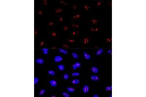 Confocal immunofluorescence analysis of U2OS cells using EBNBP2 Polyclonal Antibody (ABIN6132193, ABIN6139912, ABIN6139913 and ABIN6224909) at dilution of 1:200. (EBNA1BP2 anticorps  (AA 1-306))
