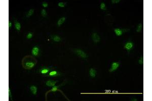 Immunofluorescence of monoclonal antibody to CBX5 on HeLa cell. (CBX5 anticorps  (AA 1-191))