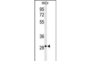 Western blot analysis of C9orf95 Antibody (N-term) (ABIN653602 and ABIN2842967) in WiDr cell line lysates (35 μg/lane). (NMRK1 anticorps  (N-Term))