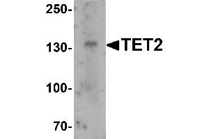 Western blot analysis of TET2 in SK-N-SH cell lysate with TET2 antibody at 1 µg/mL.