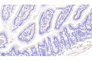 Detection of UCHL1 in Mouse Colon Tissue using Polyclonal Antibody to Ubiquitin Carboxyl Terminal Hydrolase L1 (UCHL1)