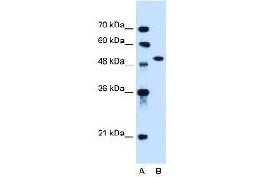 ACVR1 antibody used at 0.