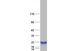 Validation with Western Blot