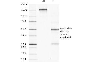 SDS-PAGE Analysis Purified ODC-1 Mouse Monoclonal Antibody (ODC1/485).
