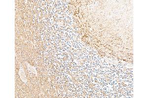 Immunohistochemistry (IHC) image for Mouse anti-Chicken IgY Light Chain (Light Chain) antibody (ABIN7795617)