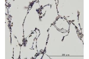 Image no. 3 for anti-Enhancer of Rudimentary Homolog (ERH) (AA 1-105) antibody (ABIN598672) (ERH anticorps  (AA 1-105))