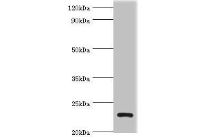 Western blot All lanes: APOBEC3C antibody at 3 μg/mL + K562 whole cell lysate Secondary Goat polyclonal to rabbit IgG at 1/10000 dilution Predicted band size: 23 kDa Observed band size: 23 kDa