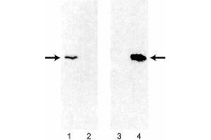 Western blot analysis of Bcl-2 expression using 3F11 and 6C8 monoclonal antibodies in human and mouse thymocytes. (Bcl-2 anticorps)