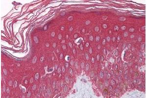 Human Skin: Formalin-Fixed, Paraffin-Embedded (FFPE)