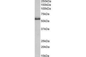 AP31402PU-N CD120b antibody staining of Rat Spinal Cord lysate at 0. (TNFRSF1B anticorps  (Internal Region))