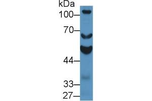 Detection of ALDH1A2 in Mouse Testis lysate using Polyclonal Antibody to Aldehyde Dehydrogenase 1 Family, Member A2 (ALDH1A2)