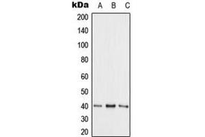 Western blot analysis of Adenosine Kinase expression in HepG2 (A), NIH3T3 (B), PC12 (C) whole cell lysates.