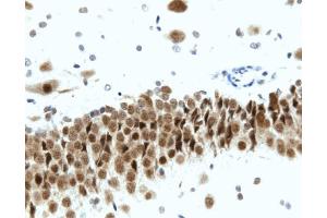 Immunohistochemistry: Rat hippocampus, formalin-fixed paraffin-embedded tissue, with citrate pre-treatment (20X magnification).