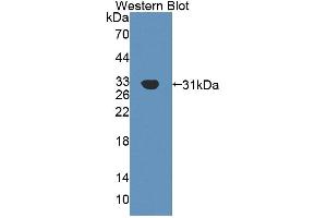 Western blot analysis of the recombinant protein. (AGRN anticorps  (AA 1329-1548))