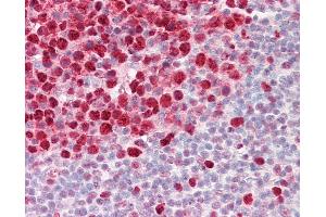 Anti-PCNA / Cyclin antibody IHC of human tonsil. (PCNA anticorps)