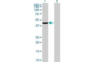 Western Blot analysis of ZNF707 expression in transfected 293T cell line by ZNF707 MaxPab polyclonal antibody. (ZNF707 anticorps  (AA 1-369))