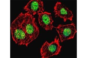 Fluorescent confocal image of U251 cell stained with p53 antibody at 1:25.