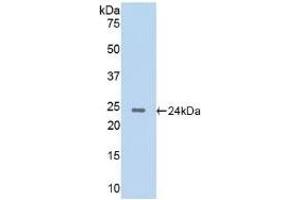 Detection of Recombinant CTSG, Rat using Polyclonal Antibody to Cathepsin G (CTSG) (Cathepsin G anticorps  (AA 51-250))