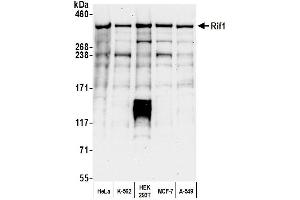 Western Blotting (WB) image for anti-RAP1 Interacting Factor Homolog (RIF1) (AA 1425-1450) antibody (ABIN7454645) (RIF1 anticorps  (AA 1425-1450))