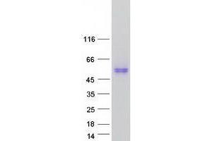 Validation with Western Blot