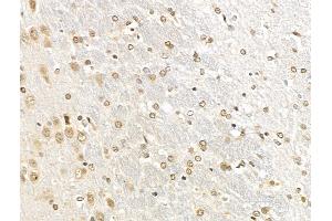 ABIN7094789 and ABIN7098840 at 1/100 staining Rat brain tissue by IHC-P. (IRF8 anticorps  (Internal Region))