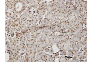 Immunoperoxidase of monoclonal antibody to HIPK1 on formalin-fixed paraffin-embedded human salivary gland. (HIPK1 anticorps  (AA 330-430))