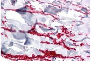 Human Skin, Dermis: Formalin-Fixed, Paraffin-Embedded (FFPE) (FAM59A anticorps  (C-Term))