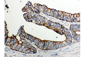 Anti- Cytochrome C Picoband antibody, IHC(P) IHC(P): Human Intestinal Cancer Tissue