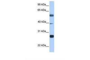 Image no. 1 for anti-MAX Dimerization Protein 3 (MXD3) (N-Term) antibody (ABIN6737887) (MXD3 anticorps  (N-Term))