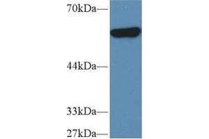 Detection of PKM2 in Human MCF7 cell lysate using Polyclonal Antibody to Pyruvate kinase isozymes M2 (PKM2)