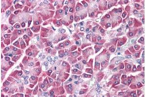 Human Pancreas: Formalin-Fixed, Paraffin-Embedded (FFPE)