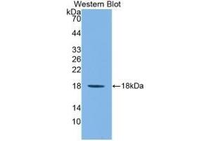 Detection of Recombinant IL1F9, Mouse using Monoclonal Antibody to Interleukin 1 Family, Member 9 (IL1F9) (IL1F9 anticorps  (AA 5-149))