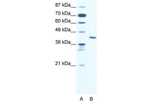 Human Jurkat; WB Suggested Anti-ZNF621 Antibody Titration: 2. (ZNF621 anticorps  (Middle Region))