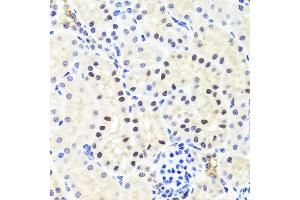 Immunohistochemistry of paraffin-embedded mouse kidney using RUNX1 antibody at dilution of 1:100 (x40 lens). (RUNX1 anticorps)